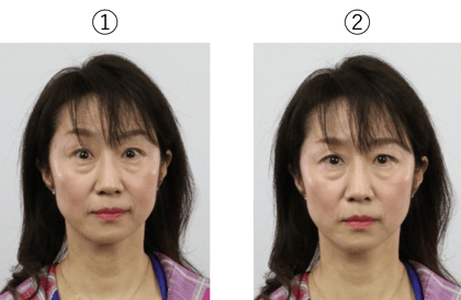 両親の表情から感情を推測する-1